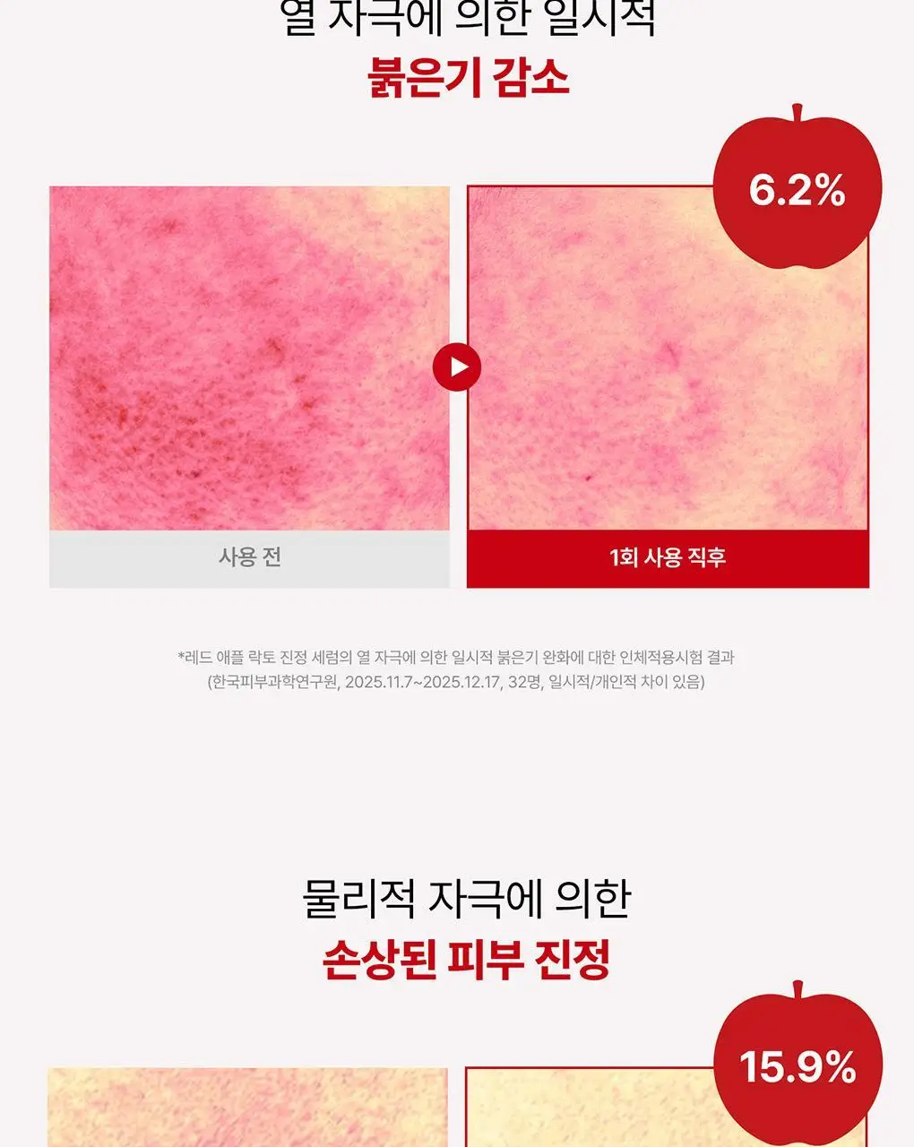 [NEW] rdrd 레드 애플 락토 진정 세럼 30ml 상세페이지 23